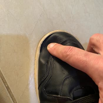 Deichmann Ayakkabısında Erken Açılma Ve Garanti Sorunu