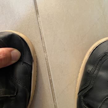 Deichmann Ayakkabısında Erken Açılma Ve Garanti Sorunu