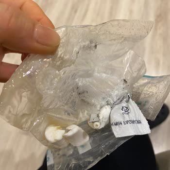 Hasarlı Göz Kremi Ve İdefix'in İlgisizliği