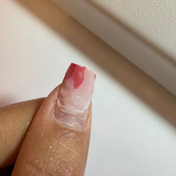 Dermatech Beauty Tırnak Bakımı Hizmeti Memnuniyetsizliği