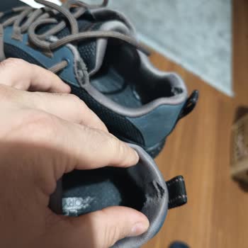 Skechers Ayakkabıda Erken Deformasyon Ve Yetersiz Garanti Hizmeti