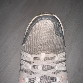 Skechers Ayakkabıda Çatlama Ve Boyner'in İlgisizliği
