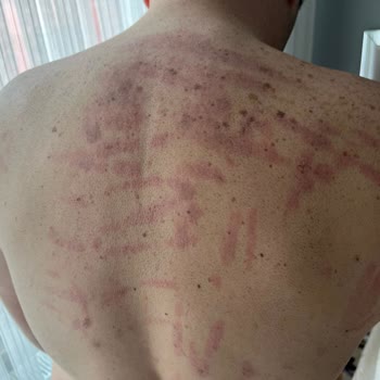 Batı Ess Yanıltıcı Güzellik Hizmetleri Ve Müşteri Memnuniyetsizliği