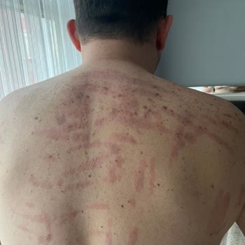 Batı Ess Yanıltıcı Güzellik Hizmetleri Ve Müşteri Memnuniyetsizliği