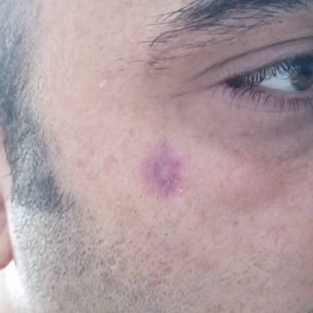 Batı Ess Yanıltıcı Güzellik Hizmetleri Ve Müşteri Memnuniyetsizliği