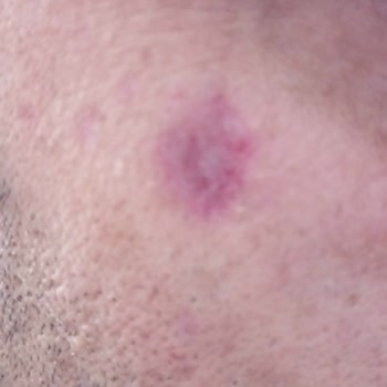 Batı Ess Yanıltıcı Güzellik Hizmetleri Ve Müşteri Memnuniyetsizliği