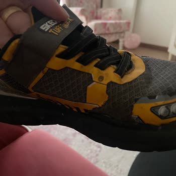 Skechers Ayakkabı 1 Ayda Deforme Oldu