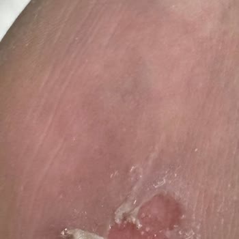 Nine West Postal Ayaklarımı Yaraladı, Müşteri Hizmetleri Çözüm Sunmadı