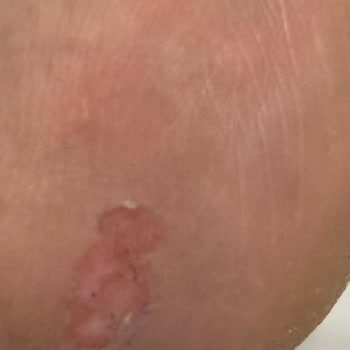 Nine West Postal Ayaklarımı Yaraladı, Müşteri Hizmetleri Çözüm Sunmadı