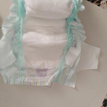 Yırtık Bezler Nedeniyle Mağduriyet Yaşıyoruz