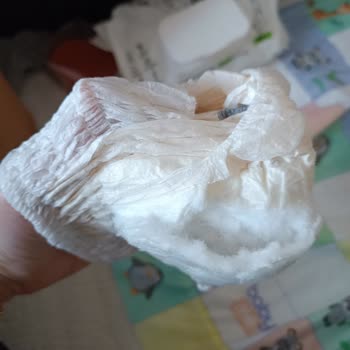 Sleepy Ecologic Külot Bez: Parçalanan Yapı Ve Yoğun Plastik Kokusuyla Hayal Kırıklığı