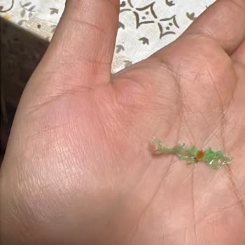 BİM'den Alınan Nugget İçinde Tehlikeli Yabancı Madde