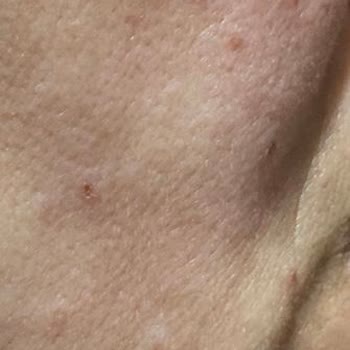 Nairobi Güzellik & Bakım Cilt Bakımında Kötü Deneyim Ve Yanıltıcı Satış