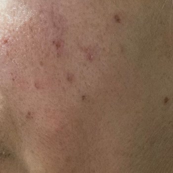 Nairobi Güzellik & Bakım Cilt Bakımında Kötü Deneyim Ve Yanıltıcı Satış