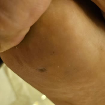 Valmenti Ayakkabıda Güvenlik Sorunu Ve İlgisizlik