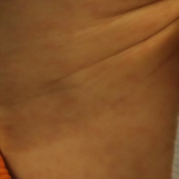 Doktor Tavsiyesiyle Aldık, Sonuç Hüsran