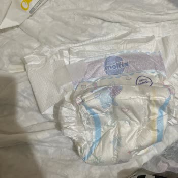 Molfix Bebek Bezlerinin Bant Sorunu