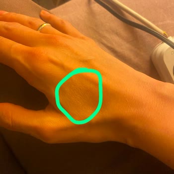 Duru Okyanus Sıvı El Sabunu Cilt Tahrişi Ve Kuruluk Sorunu