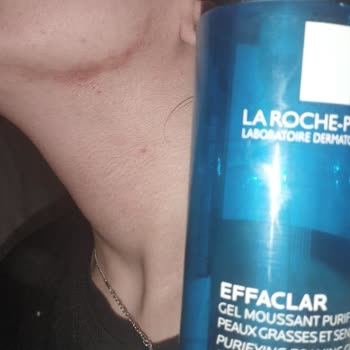 La Roche - Posay Cilt Ürünü Kızımın Cildinde Yaralara Sebep Oldu