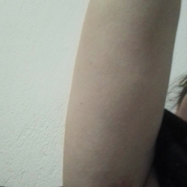 Efpily Krem Koltuk Altımın Her Tarafını Yara Yaptı