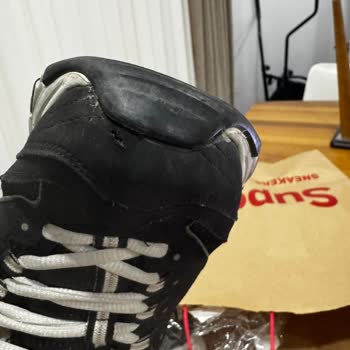 Skechers Ayakkabılarında Beklenmedik Delinme Sorunu