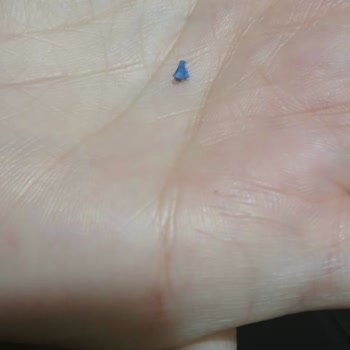 Torku Bisküvi İçinden Plastik Parçası Çıktı!