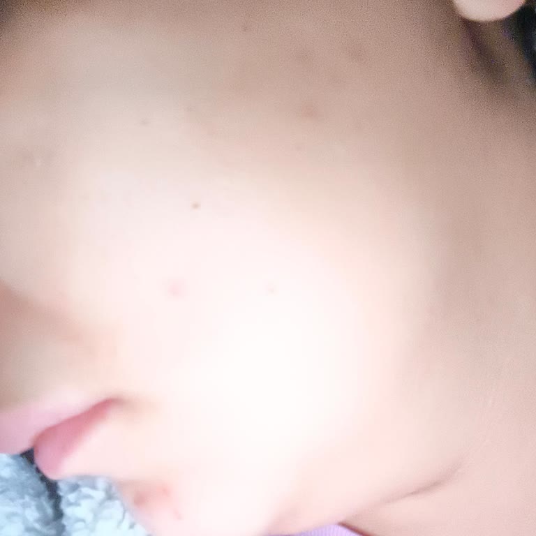 Bioderma Atoderm Yüzümü Mahvetti