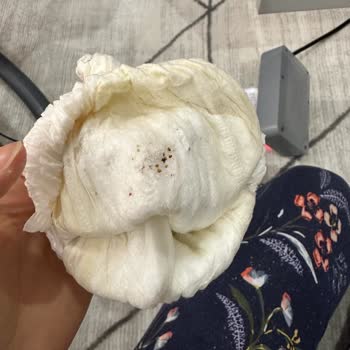 Sleepy Bebek Bezinde Sızdırma Ve Kalite Sorunları