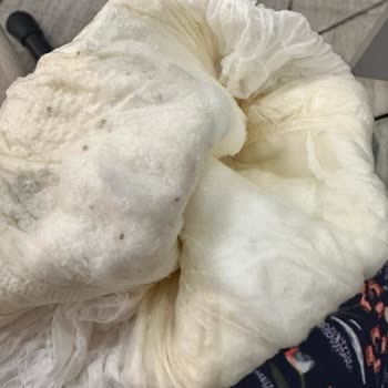 Sleepy Bebek Bezinde Sızdırma Ve Kalite Sorunları