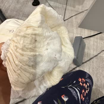 Sleepy Bebek Bezinde Sızdırma Ve Kalite Sorunları