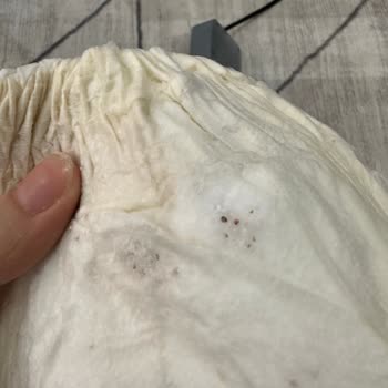 Sleepy Bebek Bezinde Sızdırma Ve Kalite Sorunları