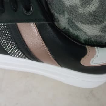 Ayakkabının Bilek Kısmı Yara Yapıyor