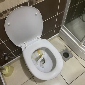 Hastane Hizmetlerinde Şok Edici Deneyim