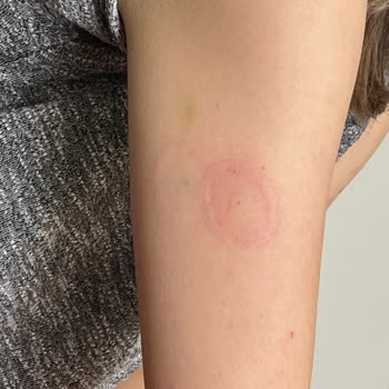 Sinyal Kaybı Ve Garanti Sorunlarıyla Mücadele