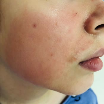 Orijinal Olmayan Ürünler Yüzünden Mağduriyet