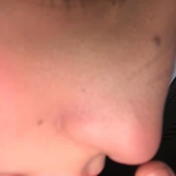 Pastel Cover+Perfect SPF30 Kapatıcı İle Hayal Kırıklığı