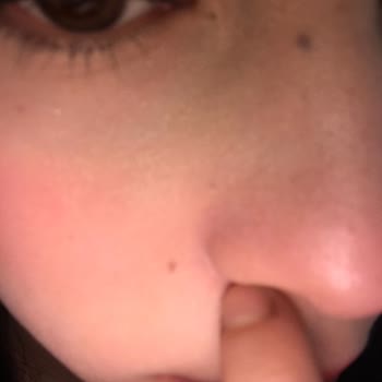 Pastel Cover+Perfect SPF30 Kapatıcı İle Hayal Kırıklığı