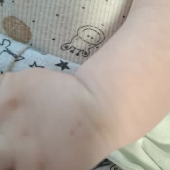 Gaziantep Şehir Hastanesi'nde Yetersiz Çocuk Acil Hizmeti