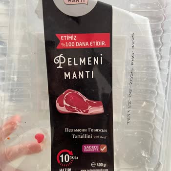 Migros'tan Aldığım Üründe Hijyen Sorunu