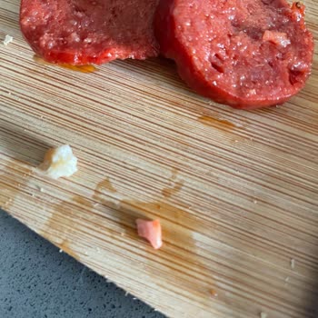 Sucukta Kemik Ve Sinir Şoku