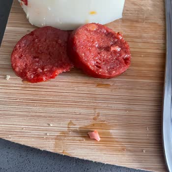 Sucukta Kemik Ve Sinir Şoku