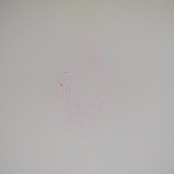 Samsung Monitör Alışverişinde Ölü Piksel Ve İade Sorunu!