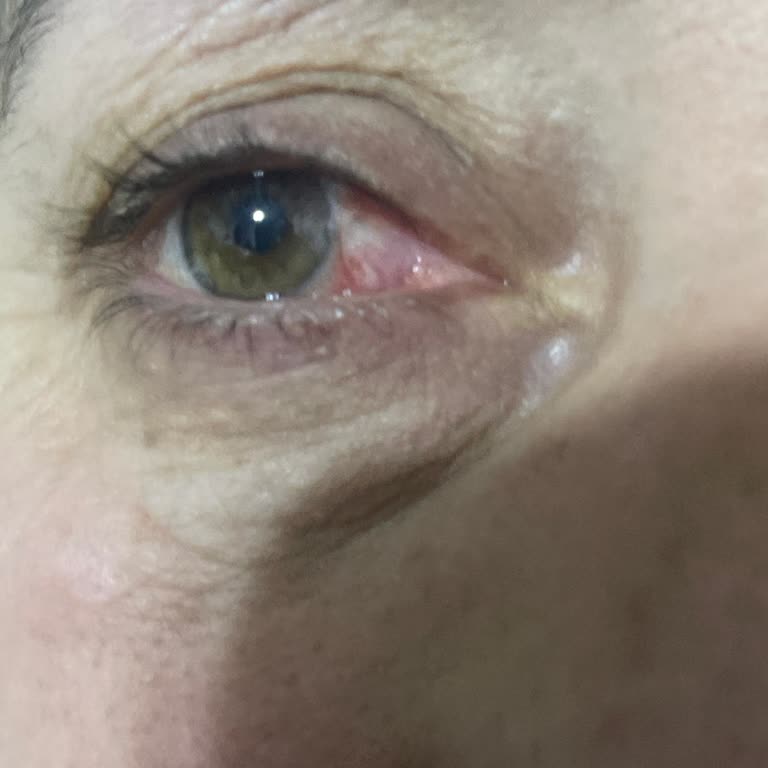 Veni Vidi Göz Hastanesi'nde Yaşanan Hasta Mağduriyeti