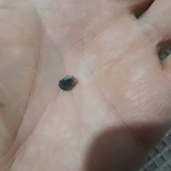 Barbunya Pilaki'de Taş Tehlikesi