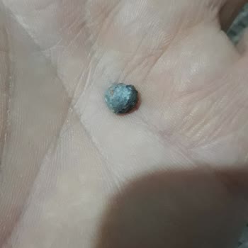 Barbunya Pilaki'de Taş Tehlikesi