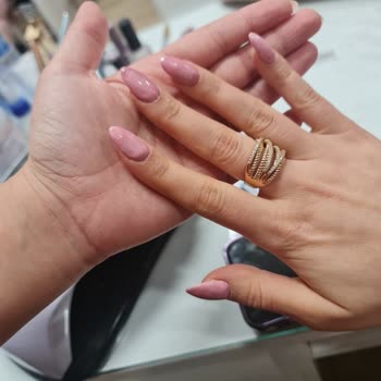 Olumsuz Deneyim: Uzun Bekleyiş Ve Yetersiz Hizmet