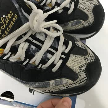 Skechers Ayakkabının Kalitesizliği Ve Garanti Sorunu