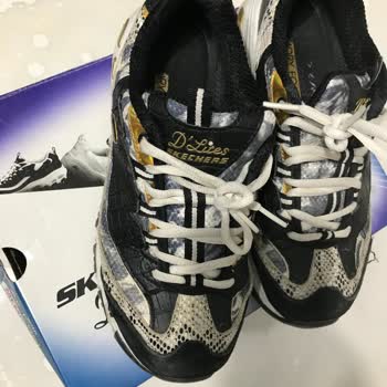 Skechers Ayakkabının Kalitesizliği Ve Garanti Sorunu