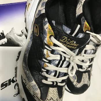 Skechers Ayakkabının Kalitesizliği Ve Garanti Sorunu