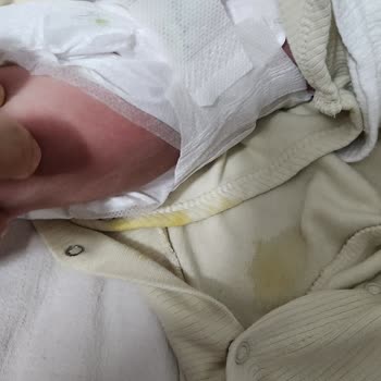 İnternetten Alınan Sleepy Bebek Bezi Kalitesizliği